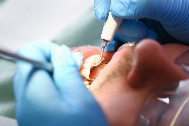 Best Walk-In Emergency Dental Services in Amory, MS